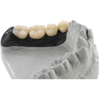 PMMA STL-Datensatz Multilayer