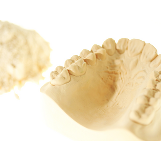 Thiesakato Hartgips Typ III gelb 20 Kg