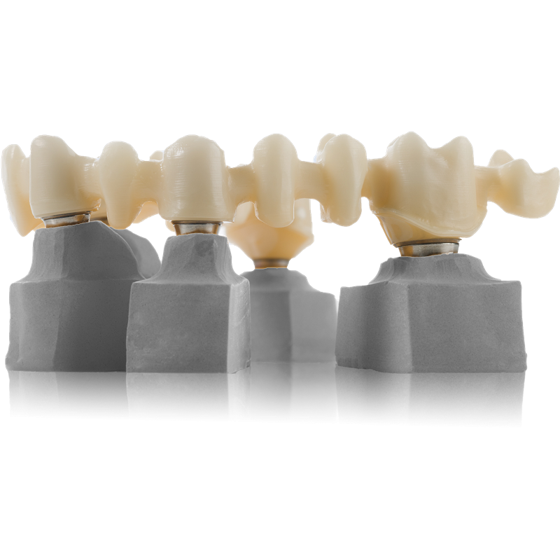 Zirconia STL-File