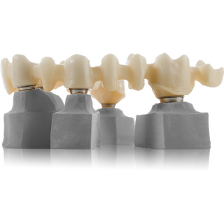 Zirconia STL-File