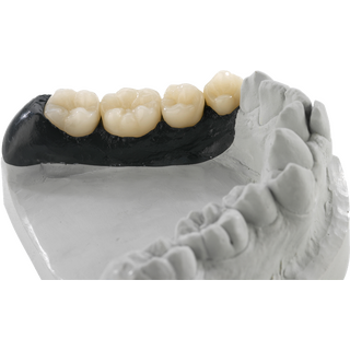 Composite STL-Datensatz VOCO Grandio Multilayer